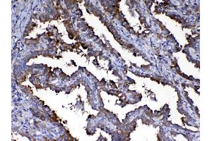 IHC analysis of Calpain 2 using anti-Calpain 2 antibody .