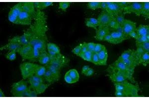 IF analysis of CA2 using anti-CA2 antibody (ABIN6719533). (CA2 anticorps  (AA 2-260))