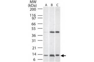 Western blot analysis of TNFRSF12A in A) human liver lysate, B) mouse liver tissue lysate, and C) rat liver lysate. (TNFRSF12A anticorps  (AA 104-118))