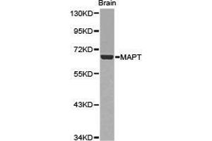 Western Blotting (WB) image for anti-Microtubule-Associated Protein tau (MAPT) antibody (ABIN1873639) (MAPT anticorps)
