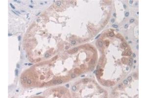 Detection of LDHD in Human Kidney Tissue using Polyclonal Antibody to Lactate Dehydrogenase D (LDHD)