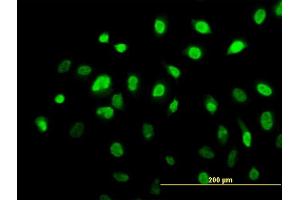 Immunofluorescence of monoclonal antibody to AHR on HeLa cell.