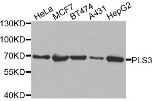 Western blot analysis of extracts of various cells, using PLS3 antibody. (Plastin 3 anticorps)
