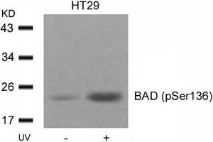 Western blot analysis of extracts from HT29 cells untreated or treated with UV using BAD(Phospho-Ser136) Antibody. (BAD anticorps  (pSer136))