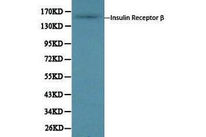 Western Blotting (WB) image for anti-Insulin Receptor beta (ISR-beta) antibody (ABIN1873245) (ISR-beta anticorps)