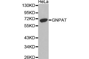 Western Blotting (WB) image for anti-Glyceronephosphate O-Acyltransferase (GNPAT) antibody (ABIN1872854) (GNPAT anticorps)