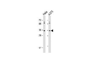All lanes : Anti-OR5AK2 Antibody (C-term) at 1:1000 dilution Lane 1: Hela whole cell lysate Lane 2:  whole cell lysate Lysates/proteins at 20 μg per lane. (OR5AK2 anticorps  (C-Term))