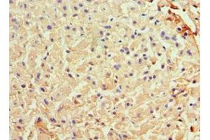 Immunohistochemistry of paraffin-embedded human liver tissue using ABIN7144581 at dilution of 1:100 (Liver Arginase anticorps  (AA 1-322))
