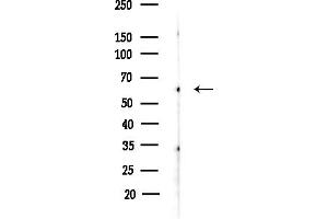Western blot analysis of lysates from COLO205 cells(heat-shock,45 min treatment), using SMG9 Antibody at 1/1000 dilution.