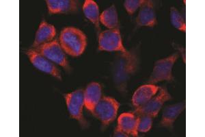 Immunofluorescence staining (rat basophils) Immunofluorescence staining of vesicles (red) in RBL-2H3 rat basophilic leukemia cell line using anti-Kinesin (KN-02). (Kinesin (heavy chain) anticorps)