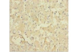 Immunohistochemistry of paraffin-embedded human liver tissue using ABIN7151627 at dilution of 1:100 (NEIL1 anticorps  (AA 2-390))