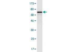 Western Blot detection against Immunogen (62.