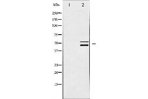 Western blot analysis of Shc expression in CalyculinA treated HeLa whole cell lysates,The lane on the left is treated with the antigen-specific peptide. (SHC1 anticorps)