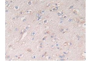 IHC-P analysis of Human Brain Tissue, with DAB staining. (ATF6 anticorps  (AA 423-646))