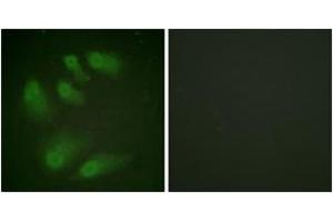 Immunofluorescence analysis of HeLa cells, using Chk1 (Phospho-Ser286) Antibody. (CHEK1 anticorps  (pSer286))