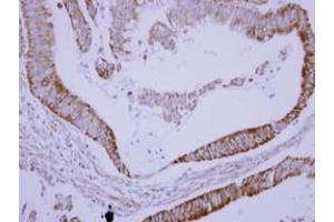 Image no. 1 for anti-SH3-Domain Binding Protein 5 (SH3BP5) (AA 108-455) antibody (ABIN1500916)