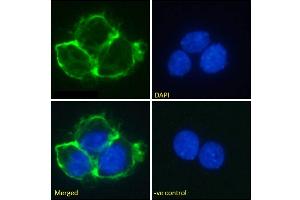 Immunofluorescence staining of fixed A431 cells with anti-EGFR antibody Matuzumab. (Recombinant EGFR (Matuzumab Biosimilar) anticorps  (Extracellular Domain))
