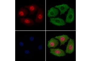 ABIN6256342 and ABIN6267479 staining Hela cells(4h of LPS treatment) by IF/ICC. (beta Catenin anticorps  (pSer45, pThr41))