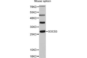 Western blot analysis of extracts of mouse spleen, using SOCS3 antibody (ABIN5970268) at 1:3000 dilution. (SOCS3 anticorps)