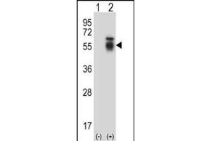 Western blot analysis of ACVR1 (arrow) using rabbit polyclonal ACVR1 Antibody (Center) (ABIN657777 and ABIN2846752). (ACVR1 anticorps  (AA 132-161))