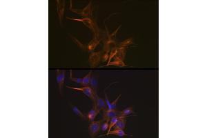 Immunofluorescence analysis of NIH-3T3 cells using Tubulin beta-1 chain Rabbit mAb (ABIN7271045) at dilution of 1:100 (40x lens). (TUBB1 anticorps)