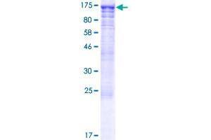 Image no. 1 for CWC22 Spliceosome-Associated Protein Homolog (CWC22) (AA 1-908) protein (GST tag) (ABIN1350786)