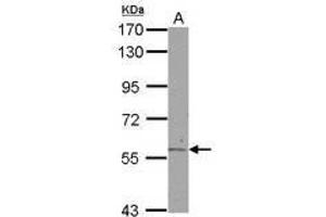 Image no. 2 for anti-Aldehyde Dehydrogenase 6 Family, Member A1 (ALDH6A1) (AA 1-255) antibody (ABIN1496604) (ALDH6A1 anticorps  (AA 1-255))