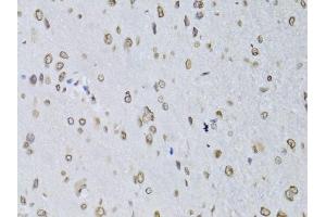 Immunohistochemistry of paraffin-embedded rat brain using LMNB2 Antibody (ABIN5973877) at dilution of 1/100 (40x lens). (Lamin B2 anticorps)