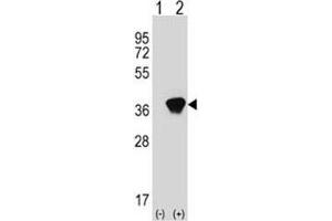 Western blot analysis of AKR1A1 antibody and 293 cell lysate (2 ug/lane) either nontransfected (Lane 1) or transiently transfected (2) with the AKR1A1 gene. (AKR1A1 anticorps  (AA 293-325))