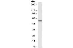 Western blot testing of human skeletal muscle lysate with DIXDC1 antibody at 0. (DIXDC1 anticorps)