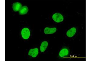 Immunofluorescence of monoclonal antibody to MCM3 on HeLa cell.