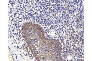 Immunohistochemistry analysis of paraffin-embedded human tonsil using PERK Polyclonal Antibody at dilution of 1:400. (PERK anticorps)