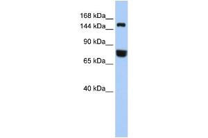 WB Suggested Anti-EEA1  Antibody Titration: 0. (EEA1 anticorps  (Middle Region))