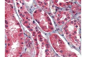 Human Kidney: Formalin-Fixed, Paraffin-Embedded (FFPE)