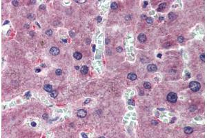 Liver, Human: Formalin-Fixed, Paraffin-Embedded (FFPE)