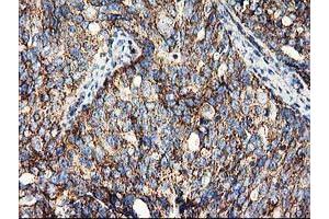 Image no. 11 for anti-ClpP Caseinolytic Peptidase, ATP-Dependent, Proteolytic Subunit Homolog (E. Coli) (CLPP) antibody (ABIN1497535)