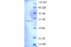 SDS-PAGE (SDS) image for Succinate Dehydrogenase Complex, Subunit A, Flavoprotein (Fp) (SDHA) (AA 44-293), (partial) protein (His tag) (ABIN5712197)