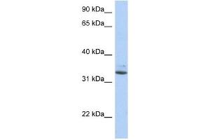 SULT1A1 antibody used at 1 ug/ml to detect target protein. (SULT1A1 anticorps  (N-Term))