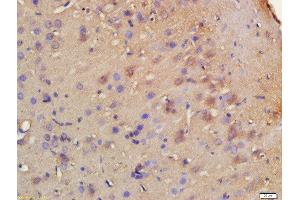 Formalin-fixed and paraffin embedded rat brain labeled with Rabbit Anti-HRH3/GPCR97 Polyclonal Antibody, Unconjugated 1:200 followed by conjugation to the secondary antibody and DAB staining (HRH3 anticorps  (AA 121-220))