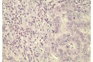 Image no. 2 for anti-Wingless-Type MMTV Integration Site Family, Member 5A (WNT5A) (AA 190-230) antibody (ABIN207746)