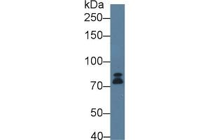 Detection of DICER1 in Human K562 cell lysate using Polyclonal Antibody to Dicer 1, Ribonuclease Type III (DICER1)