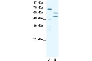 WB Suggested Anti-ZNF297B Antibody Titration: 5. (ZBTB43 anticorps  (N-Term))