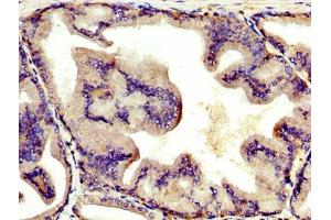 IHC image of ABIN7144136 diluted at 1:400 and staining in paraffin-embedded human prostate tissue performed on a Leica BondTM system. (AGT anticorps  (AA 44-427))