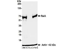Western Blotting (WB) image for anti-Nuclear Factor-kB p65 (NFkBP65) (C-Term) antibody (ABIN7795799) (Recombinant NF-kB p65 anticorps  (C-Term))