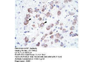 Human Brain (LARP1B anticorps  (Middle Region))