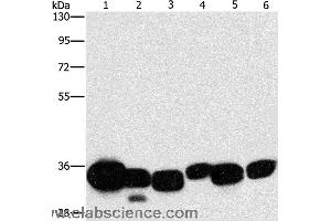 Western blot analysis of Mouse liver and human fetal lung tissue, hela cell and mouse kidney tissue, human brain malignant glioma tissue and K562 cell, using CBR1 Polyclonal Antibody at dilution of 1:1000 (CBR1 anticorps)