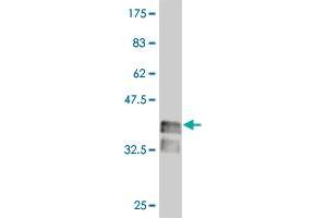 Western Blot detection against Immunogen (37 KDa) . (LHX4 anticorps  (AA 291-390))