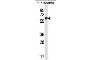 Western blot analysis in human placenta tissue lysates (35ug/lane). (GLCCI1 anticorps  (AA 226-255))