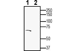 Western blot analysis of rat brain membranes: 1.