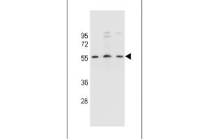 KCNK18 Antibody (Center) (ABIN657542 and ABIN2846557) western blot analysis in SiHa,,MCF-7 cell line lysates (35 μg/lane). (KCNK18 anticorps  (AA 168-197))